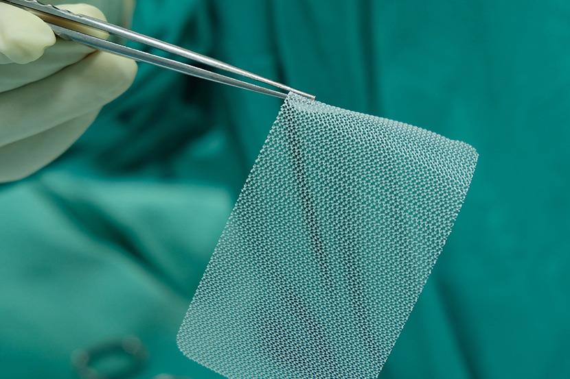 doctor holding synthetic mesh